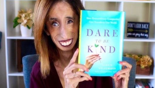 Crédito de imagen: Instagram/littlelizziev Crédito de imagen: Instagram/littlelizziev
