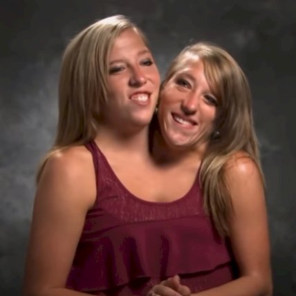 Abby and Brittany Hensel. | Source: YouTube/The 5 biggest - Montreal TV.