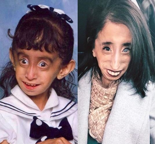Crédito de imagen: Instagram/littlelizziev Crédito de imagen: Instagram/littlelizziev
