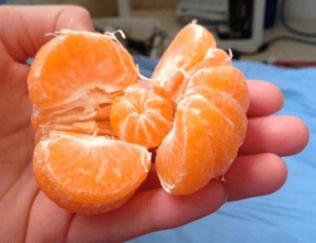 Créditos imagen: Reddit/mildlyinteresting Créditos imagen: Reddit/mildlyinteresting
