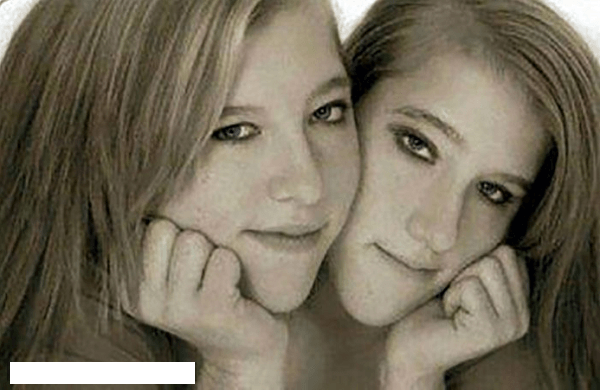Image Credit: Instagram / abbyandbrittany Image Credit: Instagram / abbyandbrittany