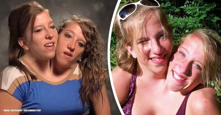 The birth of conjoined twins are rare, and the story of Abby and Brittany H...