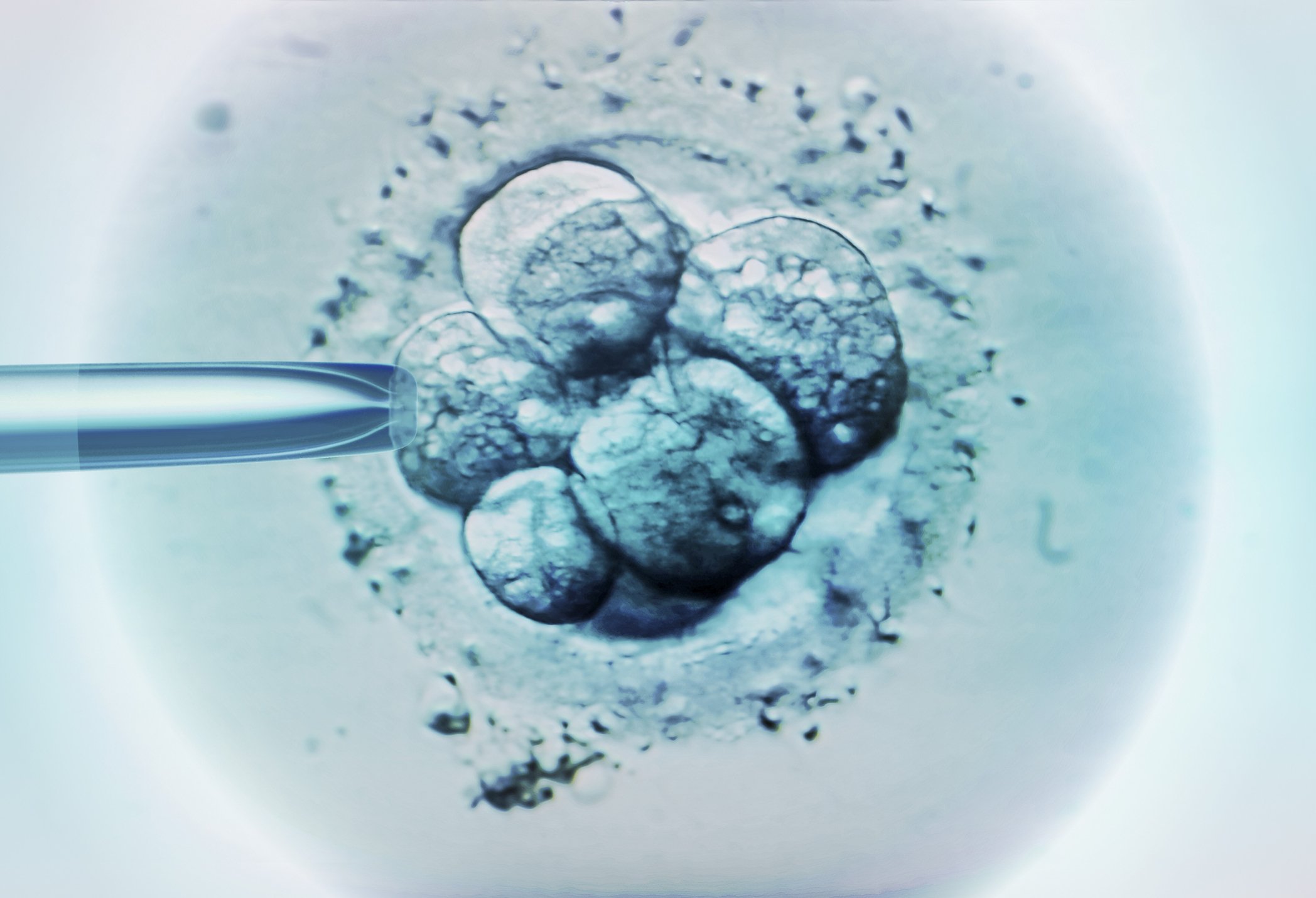 Image Credit: Getty Images/Science Photo Library-ZEPHYR/For Illustrative Purposes Image Credit: Getty Images/Science Photo Library-ZEPHYR/For Illustrative Purposes